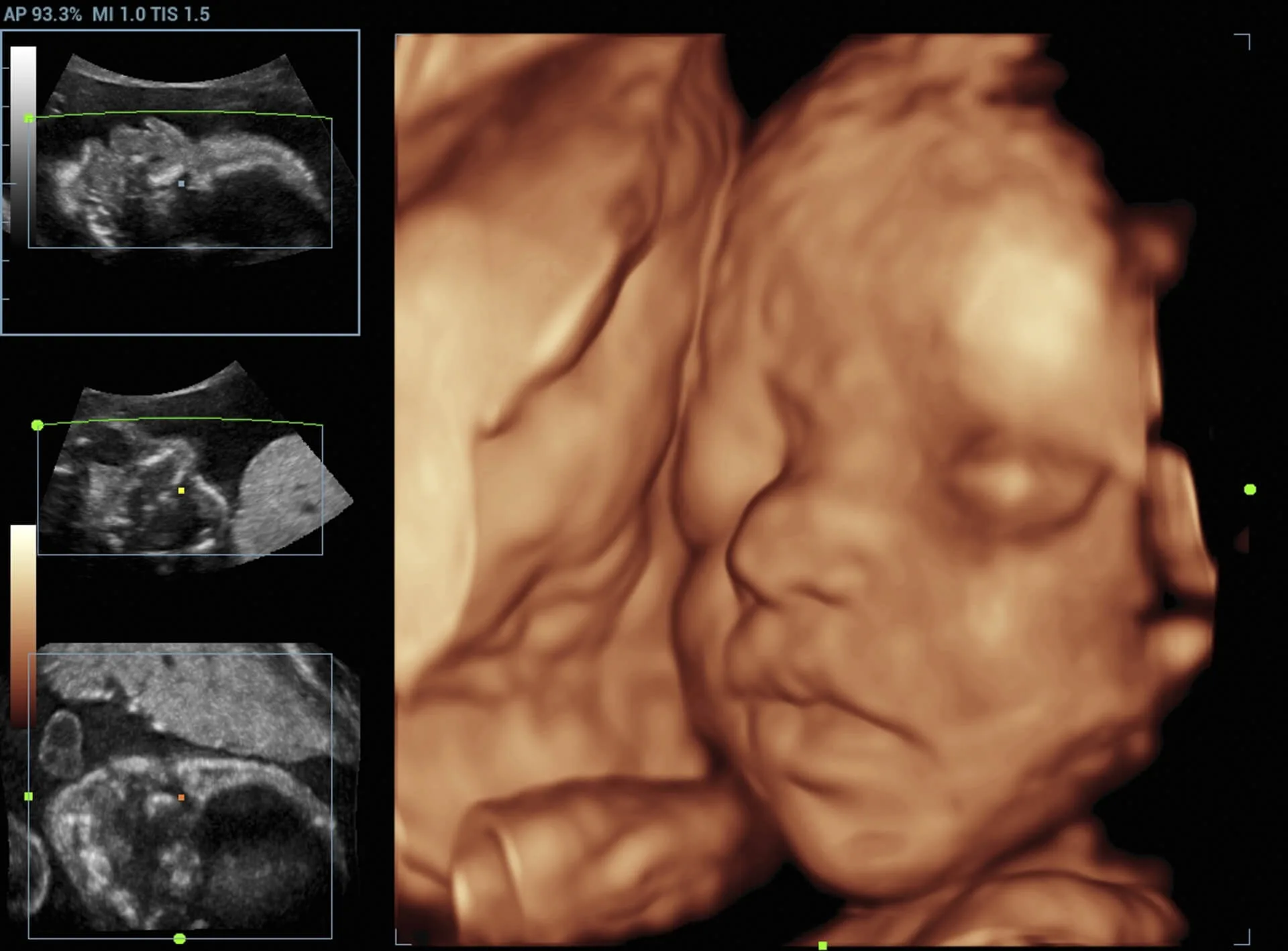 Ultrasound suite at Broad Medical Group â€